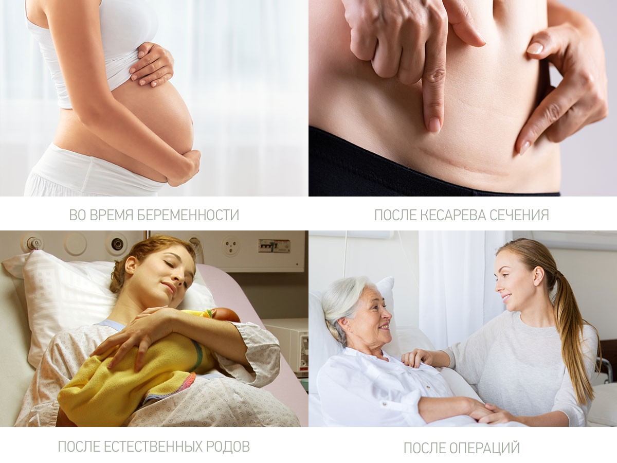 postpartum_pads_extra_32_879d7bb6a2 Прокладки Roxy Kids послеродовые EXTRA с бортиками и крылышками 32см, 10шт. 8